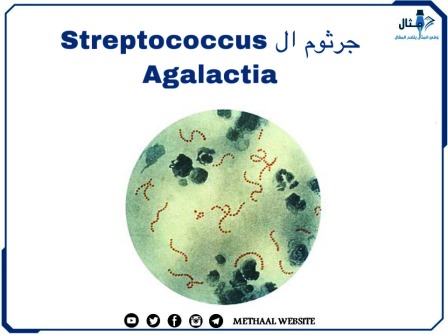 جرثوم ال Streptococcus Agalactia