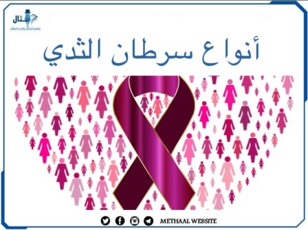 أنواع سرطان الثدي