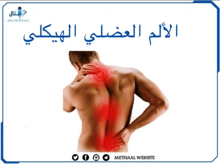 الألم العضلي الهيكلي