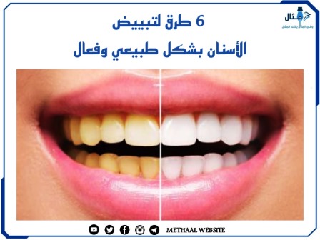  6 طرق لتبييض الأسنان بشكل طبيعي وفعال 