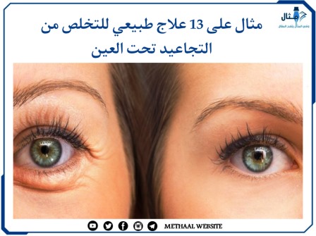 مثال على 13 علاج طبيعي للتخلص من التجاعيد تحت العين