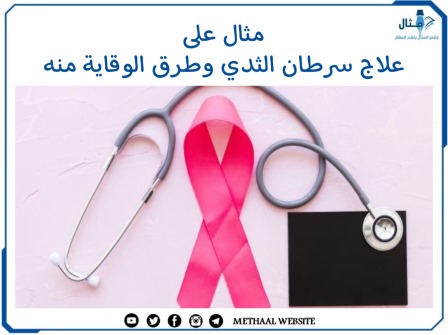 مثال على علاج سرطان الثدي وطرق الوقاية منه